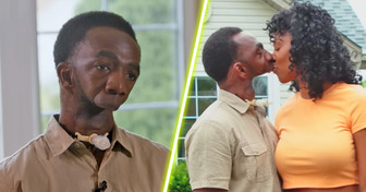 A Man Born With No Jaw Finds Love, but Their Relationship Sparks Heated Controversy: “She Can’t Kiss Him!”