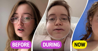 Young Singer Reveals Her Double Jaw Surgery Journey, Leaving People Stunned by the Results