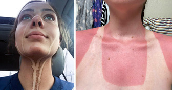 15 People So Unlucky You Just Want to Give Them a Big Hug