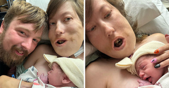 “Some People Shouldn’t Have Kids,” Woman Faces Criticism Due to Her Disability but Gives Birth to a “Perfect” Baby