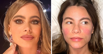18 Stars Who Don’t Need Any Makeup to Stand Out