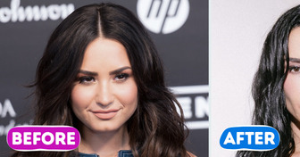 “Can She Actually Move Her Face?” Demi Lovato’s New Look Has Everyone Talking