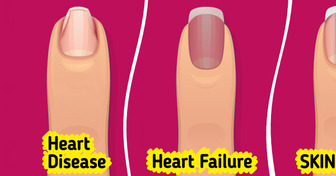 Your Body Might Be Asking for Help and Your Toenails Are the First to Show It