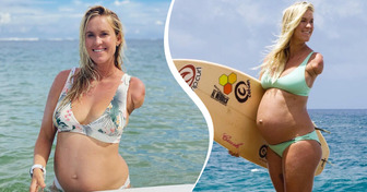 A Woman Loses an Arm Due to a Shark Attack, But Preserves Her Love for the Ocean and Her Body