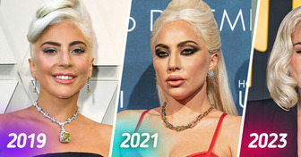 Lady Gaga’s Latest Appearance Sparks Heated Controversy and Raises Suggestions of Botox Abuse