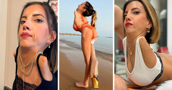 Meet a Woman Who Was Born Without Arms and a Leg. Now She’s Changing the World