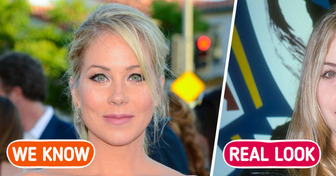 Christina Applegate Revealed She Had Her Only Plastic Surgery at a Young Age and Regrets It