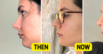 12 Times Beauty Treatments Didn’t Go as Smoothly as Expected