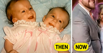 People React One of the Conjoined Twins’ Secret Wedding Sparked Curiosity Around the World