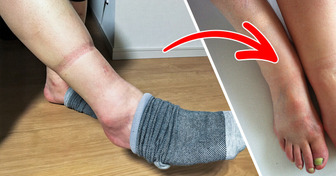 4 Health Problems Your Feet Could Be Telling You Through Sock Marks