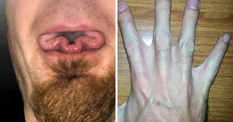 14 Unusual Features of the Human Body That Definitely Make Their Owners Stand Out From the Crowd