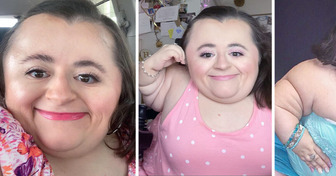 Meet Hannah, Born With a Rare Condition, Who Turned Her Dream Into Reality and Became a Beauty Influencer