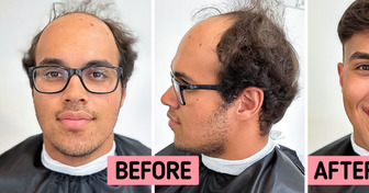 A Hairdresser Gives a New Look to Men Dealing With Hair Loss, and the Results Are Truly Remarkable