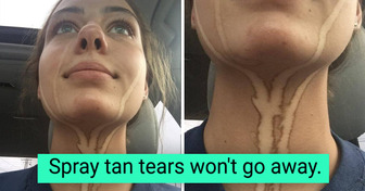 15 People So Unlucky You Just Want to Give Them a Big Hug