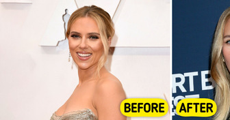 “Looks Like She Had Her Implants Removed,” Scarlett Johansson Debuts Her New Figure