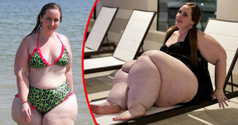 Doctors Shamed Me for Years — Until a Complete Stranger Finally Revealed the Real Problem