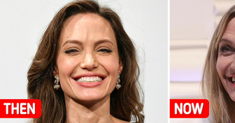 “Looks Like She Was Bitten by a VAMPIRE,” Angelina Jolie’s Latest Appearance Sparks Mixed Reactions