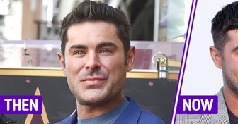 “He Dissolved the Fillers!” Zac Efron’s Latest Appearance Sparks a Heated Debate