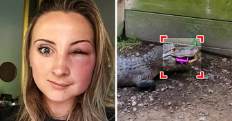 18 People Who Truly Know What It Means to Be Unlucky