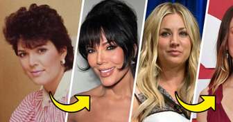 15 Stars Who Openly Embraced Cosmetic Procedures — And Love Their Results