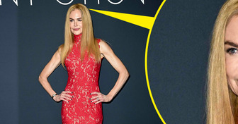 “She’s Going Bald...” One Small Detail in Nicole Kidman’s Look Is Causing Big Drama
