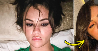 Selena Gomez Was Honest About Using Botox and Revealed the Various 'Phases' of Her Face