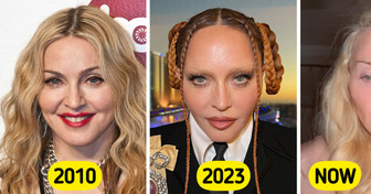 “Not Filler Free,” Fans Noticed One Peculiar Detail After Madonna Revealed Latest Selfie