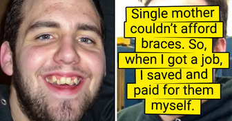 15 People Who Decided to Fix Their Crooked Teeth and Now Feel Amazing