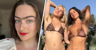 12 Women Said Goodbye to Razors and Proved That the Fuzzy Look Can Be Absolutely Gorgeous
