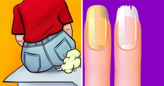 8 Weird Body Signs You’re Actually Lactose Intolerant