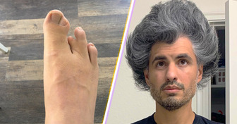 15 People Who Revealed Something Truly Unique About Their Bodies