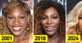 “Calm Down on the Fillers!” Serena Williams Received Backlash for Her Markedly Different Appearance