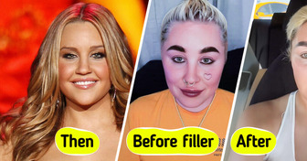 Amanda Bynes, 39, Revealed Her Dramatic New Look, Leaving People in Awe