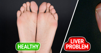 6 Unusual Warning Signs of Liver Issues You Shouldn’t Ignore