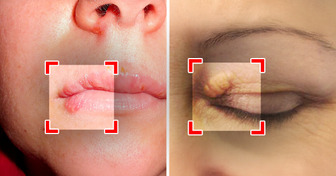 4 Signs on Your Face That Could Quietly Reveal Health Issues