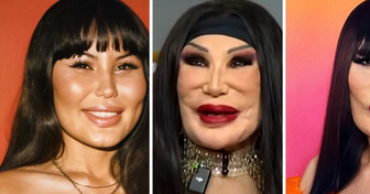Mexican Star’s Face Was Ruined by Jealousy. Years Later, She’s Owning Her Beauty Again