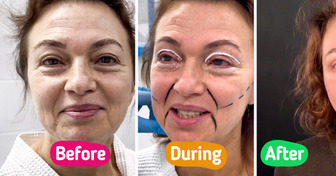 “She Needs to Change Her Passport” Woman, 58, Leaves People Speechless with Dramatic Facelift Results