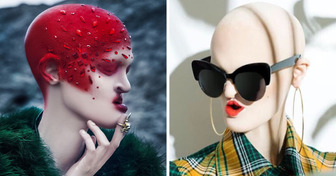 Melanie Gaydos, Model With Rare Genetic Disorder Who Shows the World That Beauty Can Be Different