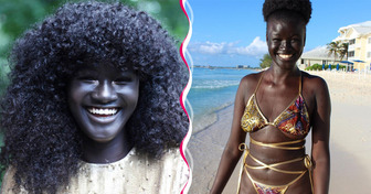A Model Who Faced Teasing for Her Intensely Dark Skin Now Inspires Young Girls and Proves Beauty Comes in Every Shade