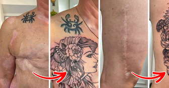 15 Times Tattoo Artists Turned Scars Into Pieces of Art