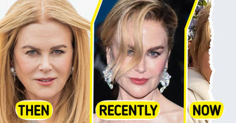 “Is That AI?” People Are Shocked by Nicole Kidman’s New Photo