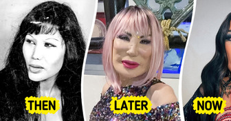 Jealousy Pushed This Mexican Star Into a Beauty Disaster — See Her Inspiring Journey of Recovery