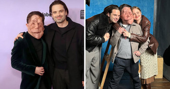 Born With a Rare Condition, He Now Acts With Hollywood Stars