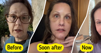 Woman, 50, Reveals Her Remarkable Plastic Surgery Results, Sparking Major Buzz Online