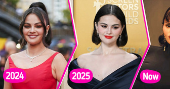 “What Happened to Her Face??” Selena Gomez’s New Look Confused Fans, Sparking Controversy