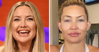 Kate Hudson Shares Beauty Secrets and Admits to Undergoing Certain Cosmetic Procedures