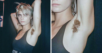 15 Celebrities Who Aren’t Afraid to Show Off Their Body Hair