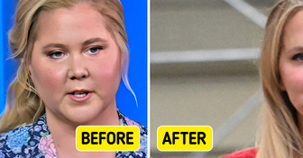 “Looked Better Before!” Amy Schumer Unrecognizable After Major Body Transformation