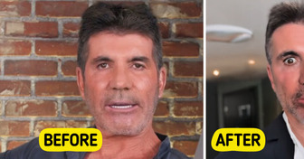 “What a Shame!” Simon Cowell’s Shocking Transformation Leaves Viewers Speechless