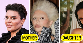 Lisa Rinna’s Daughter Revealed Plastic Surgery Procedures She’s Had, Some Details Are Truly Wild